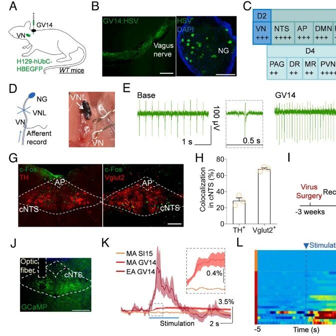 PNAS｜古法新解！浙江中医药大学陈忠/王毅证实电针刺激特定穴位可通过明确神经环路，持久抑制癫痫