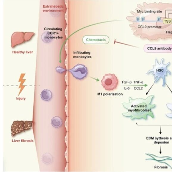 Hepatology｜天津医科大学李悦国等团队揭示肝纤维化新机制