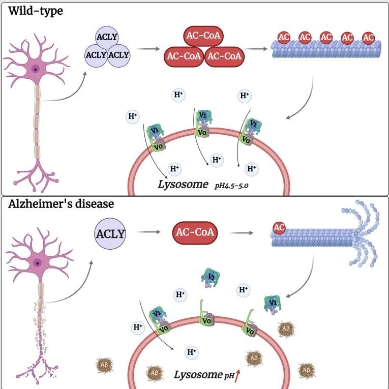 Alzheimer's & Dementia | 福建医科大学张静与陈晓春团队揭示了代谢酶ATP柠檬酸裂解酶（ACLY）在阿尔茨海默病发病中的新机制