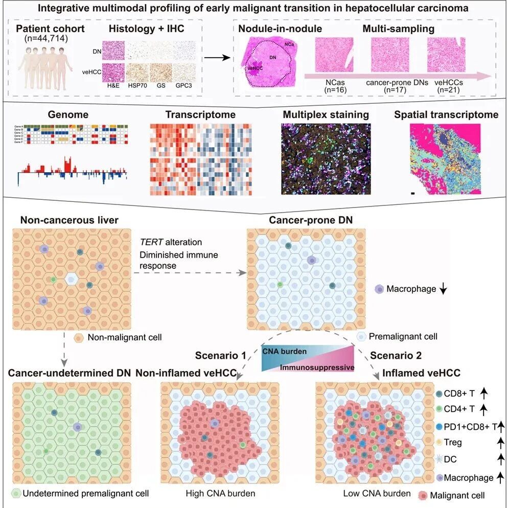 Cancer Cell | 中国科学院分子细胞科学卓越创新中心惠利健组合作解析肝癌早期恶性转变的分子与免疫演化规律