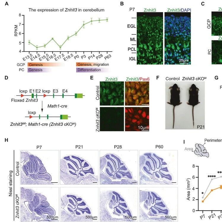 Cell Death & Differ | 复旦大学研究团队发现ZNHIT3通过调控p53/p21通路主导小脑发育，其缺失致病可被逆转