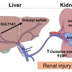 Free Radical Biology and Medicine  | 孙宏羽/施李杨团队揭示载脂蛋白J介导的肝肾互作轴驱动慢性肾病进展