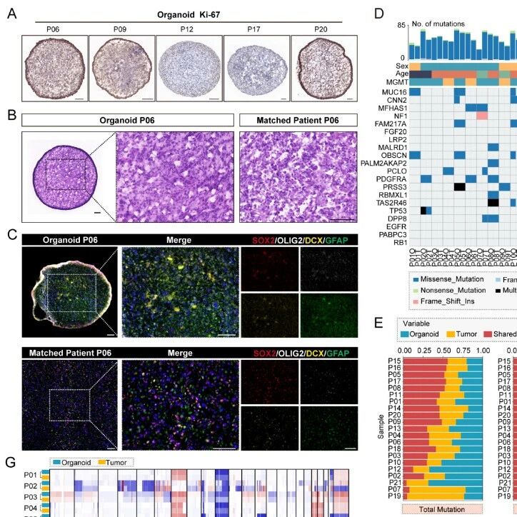 Cancer Res｜精准狙击脑瘤！首都医科大学张伟等团队开发新算法，结合类器官验证，大幅提升新抗原预测准确性