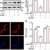 Adv Sci | 唤醒大脑的“修复力量”！山东大学宁斌团队发现IL-3可通过PRDX1“开关”调控免疫细胞治疗脑损伤