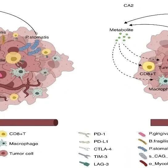 iMetaOmics | 苏州大学周哲敏/杨晓东/徐鉴城团队-联合转录组和微生物组分析揭示微生物对结直肠癌免疫调节及进展的影响