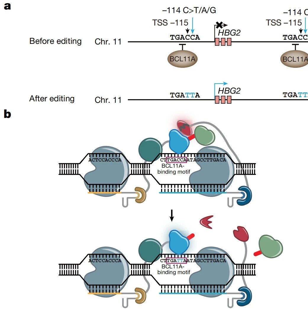 中国等学者领衔的基因编辑治疗贫血疾病迎来“多重奏”：《Nature》《NEJM》发表多项突破，碱基编辑获临床成功