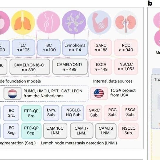 Nat Cancer | 病理AI的“开箱即用”，香港科技大学李小萌等开发无需训练，即可直接用于多癌种诊断的病理AI助手