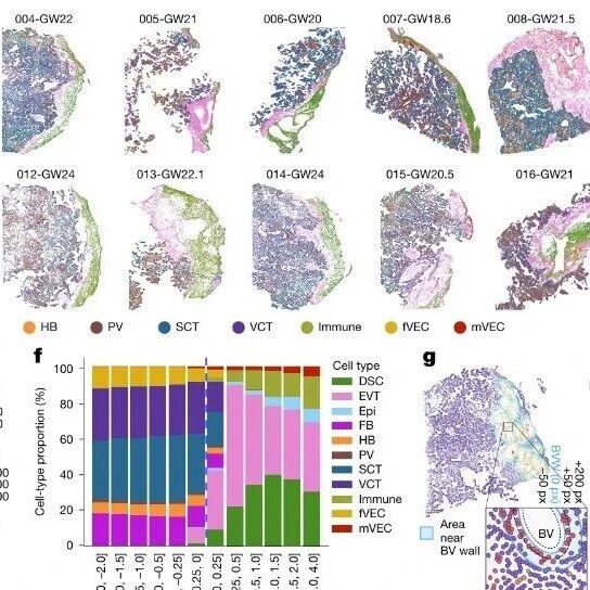 Nature | 解码生命“第一间房”：李晶晶等团队研究发布人类母胎界面高清全景图谱，可预测细胞行为与疾病风险