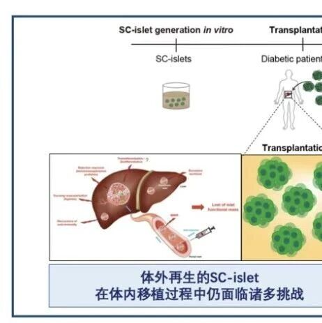 Cell Stem Cell | 同济大学李维达/晏家骢等合作提出一种用于优化干细胞来源胰岛类器官移植效果的新型预处理策略