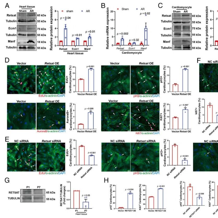 PNAS｜心脏再生新靶点竟有“双重身份”！哈尔滨医科大学蔡本志等团队揭示Retsat不靠老本行，在线粒体“兼职”促修复
