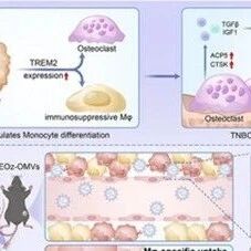 Adv Sci | 浙江大学王盛东/俞小华/叶招明开发智能纳米导弹，精准递送药物重编程骨髓免疫抑制