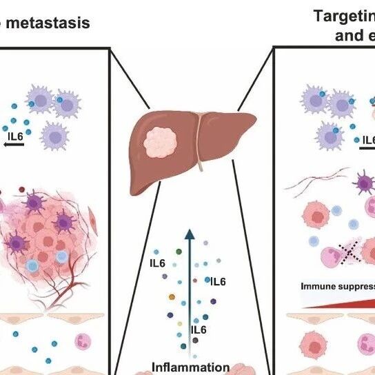 CMI | 中山大学王文宇/潘卫东团队发现肝脏转移“预警”新机制：肝细胞-LRG1轴主导免疫抑制性PMN形成，阻断后可增敏免疫治疗