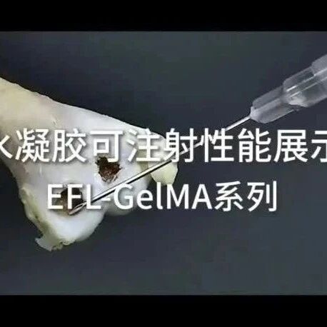 【视频集锦】光固化水凝胶可注射性展示