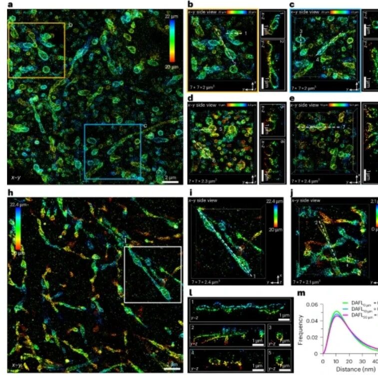 Nat Biotechnol | 一面镜子照亮细胞“微观宇宙”！西湖大学章永登团队开发新型显微技术，以极低成本实现纳米级各向同性分辨