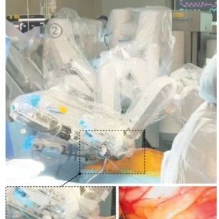 芝大田博之教授团队 Nat. Mater.：微创生物电子系统的最新进展