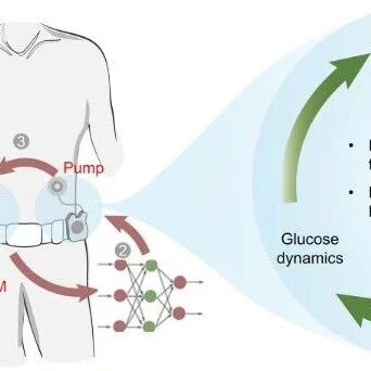 《Adv. Mater.》：港大＆浙大团队联手打造“电子+化学”双闭环系统，AI赋能糖尿病精准管理