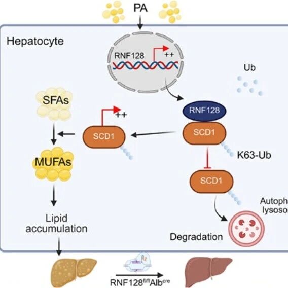 Hepatology｜肝靶向技术对抗脂肪肝！山东大学张猛/张澄利用反义寡核苷酸与基因疗法敲低RNF128，有效改善小鼠模型疾病