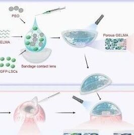 厦门大学《Journal of Controlled Release》：基于多孔GelMA水凝胶递送角膜缘干细胞治疗角膜缘干细胞缺乏症
