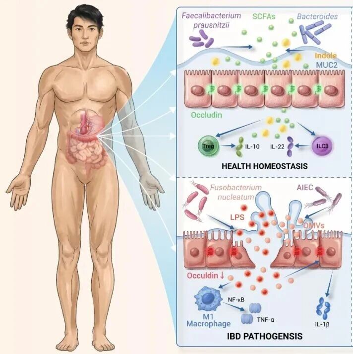 The Innovation Life | 肠道微生物-免疫轴：炎症性肠病发生与进展的新解释框架