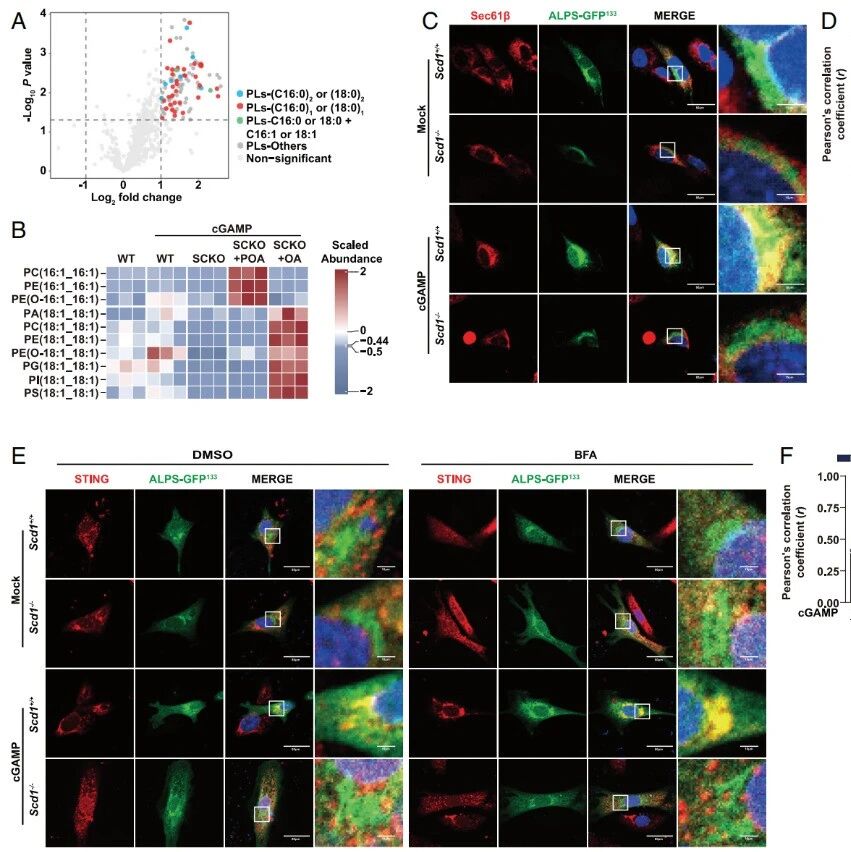 PNAS｜细胞免疫的“舞台总监”：山东大学赵伟团队发现代谢酶SCD1通过调整细胞膜“质地”来启动STING信号