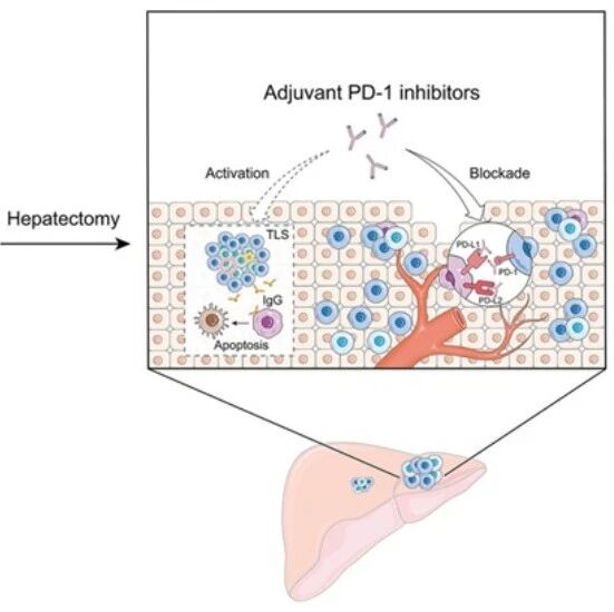 Hepatology｜广西医科大学钟鉴宏团队揭示三级淋巴结构通过塑造“热”肿瘤免疫微环境增强PD-1抑制剂术后疗效