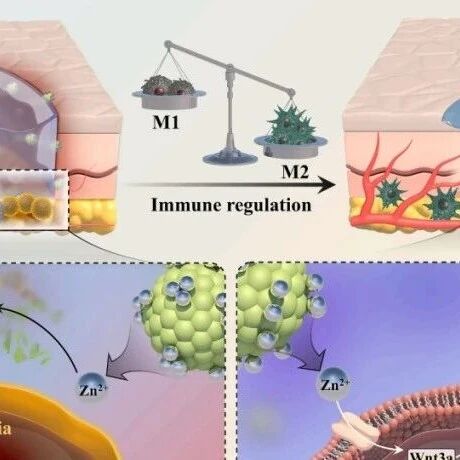 汕头大学医学院第二附属医院《Journal of Controlled Release》：智能顺序降解水凝胶促进糖尿病伤口愈合