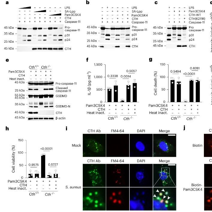 Nat Immunol | 细胞内的“分子改装师”：北京大学夏朋延等团队发现CTH酶能剪切细菌脂蛋白，组装出激活免疫警报的新信号