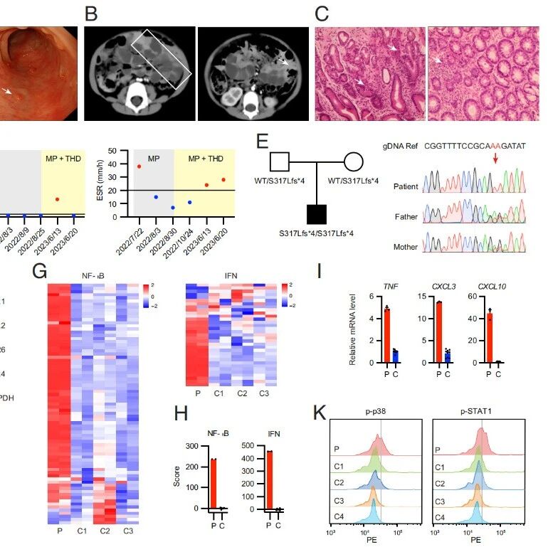 PNAS | 免疫“调节器”失灵如何引发肠炎？浙江大学周青等团队揭示TLR1基因缺陷导致免疫应答“该强时弱，该停时强”