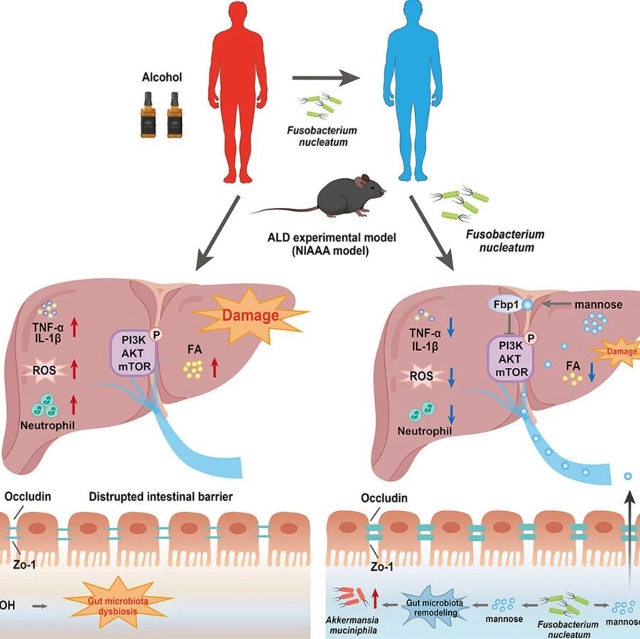 J Hepatol｜安徽医科大学王华等团队发现具核梭杆菌向肝脏“投递”甘露糖，成为治疗酒精肝的潜在新药