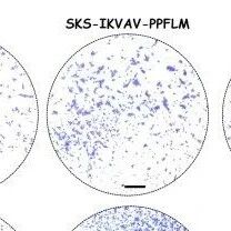 《Cell Biomater.》：促进慢性伤口愈合的弹性蛋白样重组蛋白水凝胶