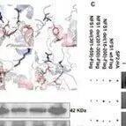 Adv Sci | 上海交通大学薛松等团队发现减轻腹主动脉瘤的潜在新策略