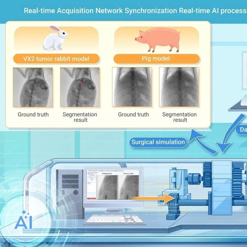 The Innovation Oncology | AI赋能，开启介入医学智能化新时代