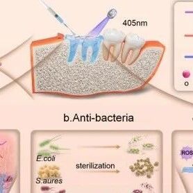 基于GelMA与氧化葡聚糖的双网络MXene水凝胶用于糖尿病性骨缺损修复