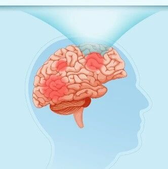 The Innovation Drug Discovery | 纳米载体介导中药单体跨血脑屏障递送的相关策略、挑战与转化前景