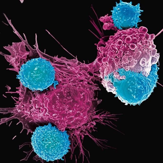Autophagy | 柴进、路嘉宏团队揭示黏着斑激酶抑制剂诱导胰腺癌细胞保护性自噬新机制
