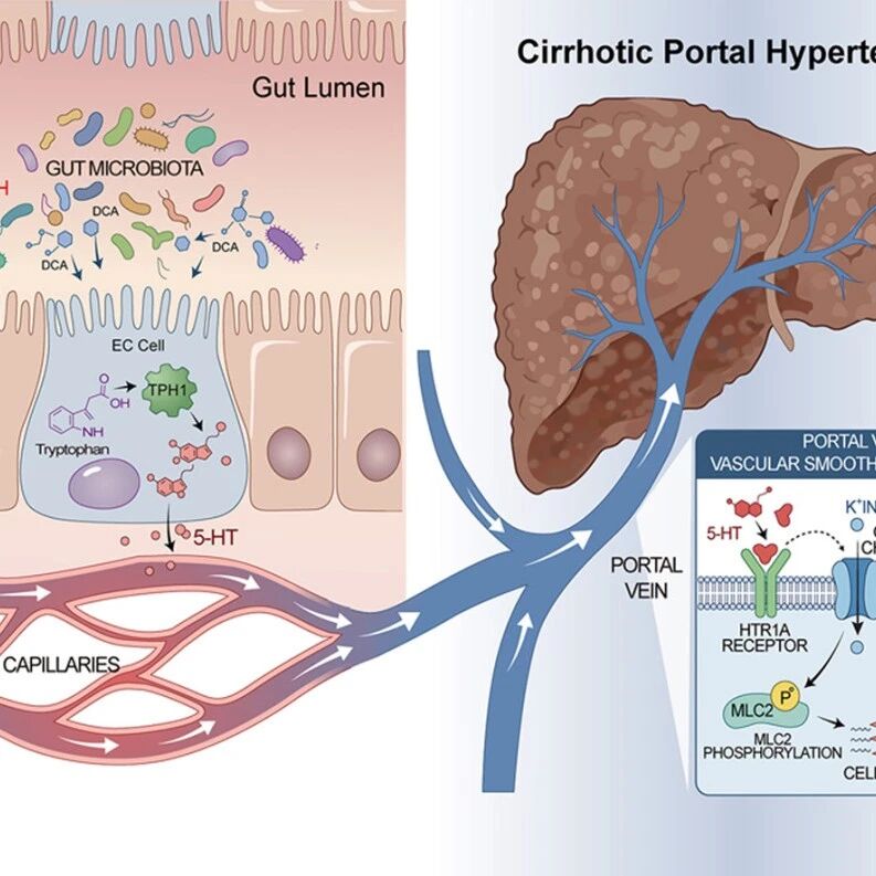 J Hepatol | 海军军医大学谢渭芬等发现，利福昔明通过抑制菌源性脱氧胆酸改善肝硬化门脉高压