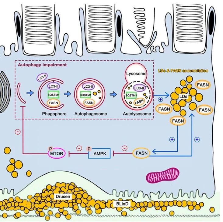 Autophagy | 锁定视力健康的“制动器”：重庆医科大学杨培增等团队发现FASN蛋白累积会“锁死”细胞自噬，驱动黄斑变性早期病变