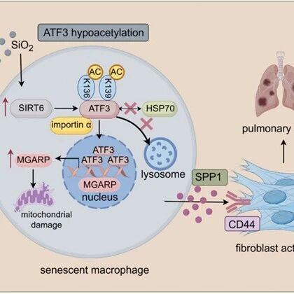 南通市环境毒理学重点实验室Adv. Sci.：SIRT6介导ATF3去乙酰化修饰通过结合核转运蛋白Importin α促进ATF3入核，促进矽尘诱导的肺纤维化