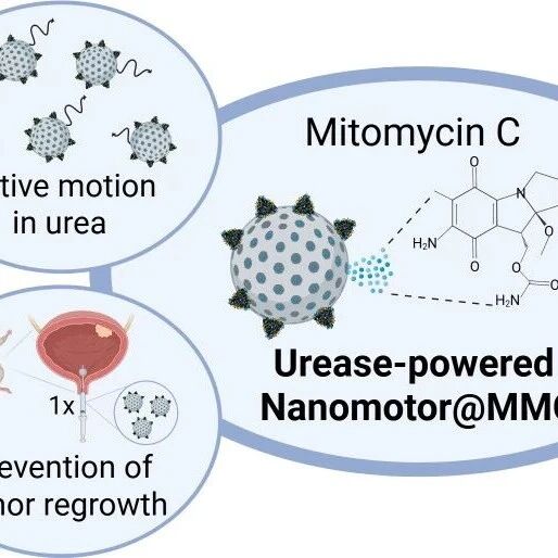 Nano Lett：纳米马达辅助的膀胱内化疗可缩小膀胱肿瘤和抑制早期肿瘤复发