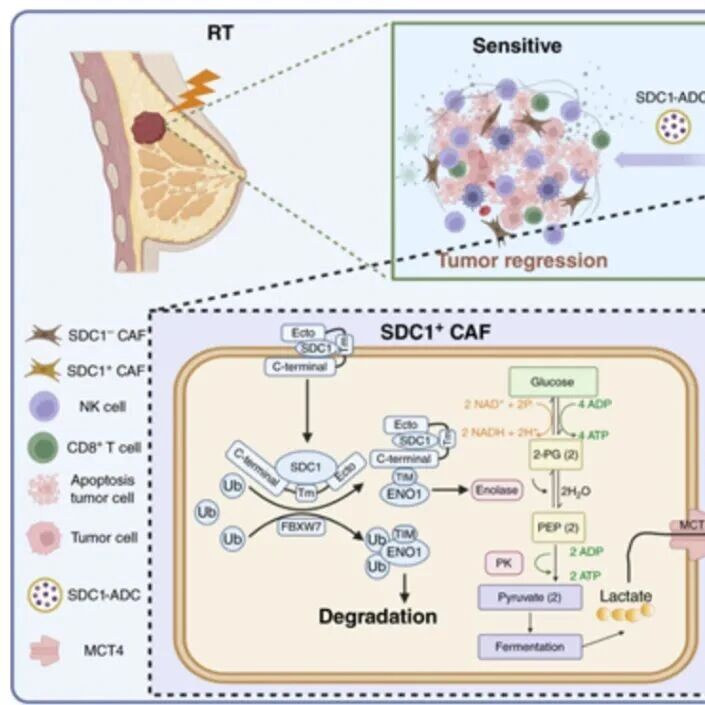 Cancer Res | 肿瘤的“代谢帮凶”：复旦大学刘杰等团队揭示癌症相关成纤维细胞如何制造乳酸“保护罩”助长放疗抵抗