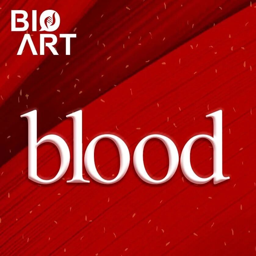 Blood | 苏瑞揭示METTL1/m⁷G轴在髓系白血病中的作用机制及其治疗潜力