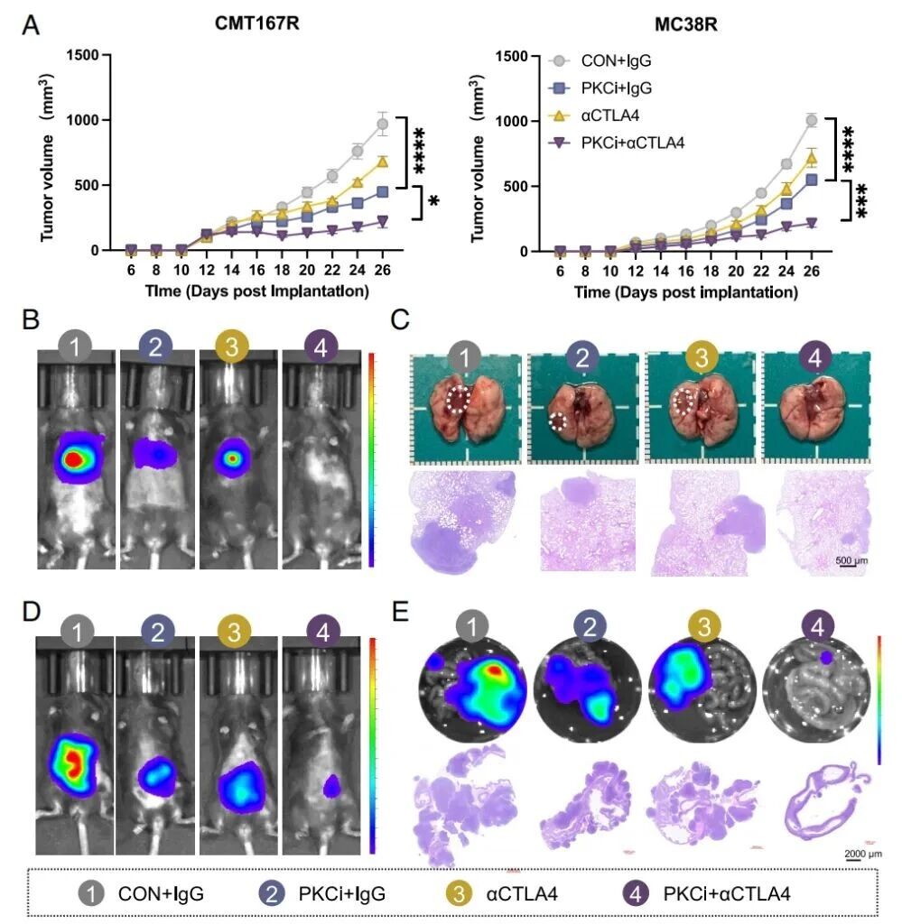 PNAS | 肿瘤免疫耐药的“防火墙”：山东第一医科大学陈大卫等揭示XIAP-PKC轴如何被攻破以重激活PD-1治疗