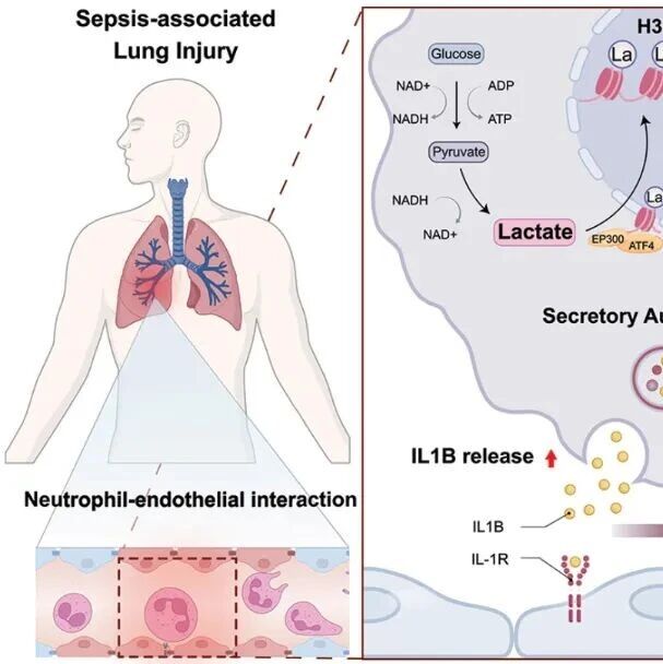 Autophagy | 上海交通大学瞿洪平等团队发现脓毒症内皮损伤治疗新靶点