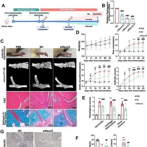 Adv Sci：中山大学肖游君等团队发现类风湿关节炎治疗新策略