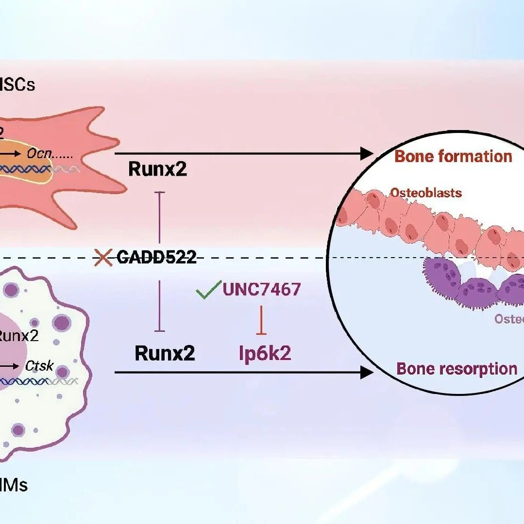 Nat Commun | 南科大曹惠玲团队揭示Ip6k2–Runx2在骨质疏松中作用和分子机制