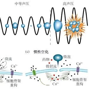 声波之刃——超声治疗原理与应用