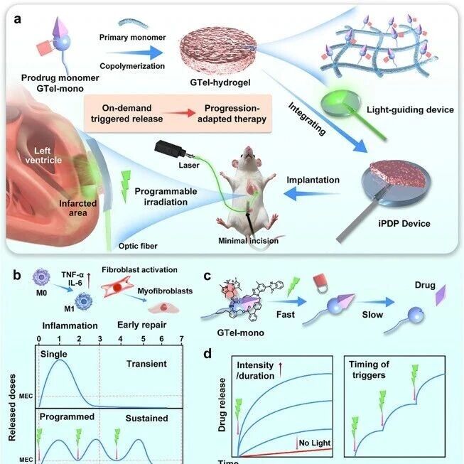 Adv Sci：闪光一次，自动给药：浙江大学任探琛等发现植入式光控贴片实现心肌梗死后“按需分次”主动治疗