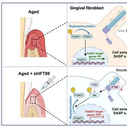 Aging Cell | 水生所联合武汉大学口腔医院揭示初级纤毛调控牙龈成纤维细胞衰老的新机制