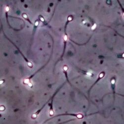24小时热门｜最悲观预测：全球男性精子浓度或在2045年趋近于零？｜Nature：首次在淡水鱼中发现传染性癌症
