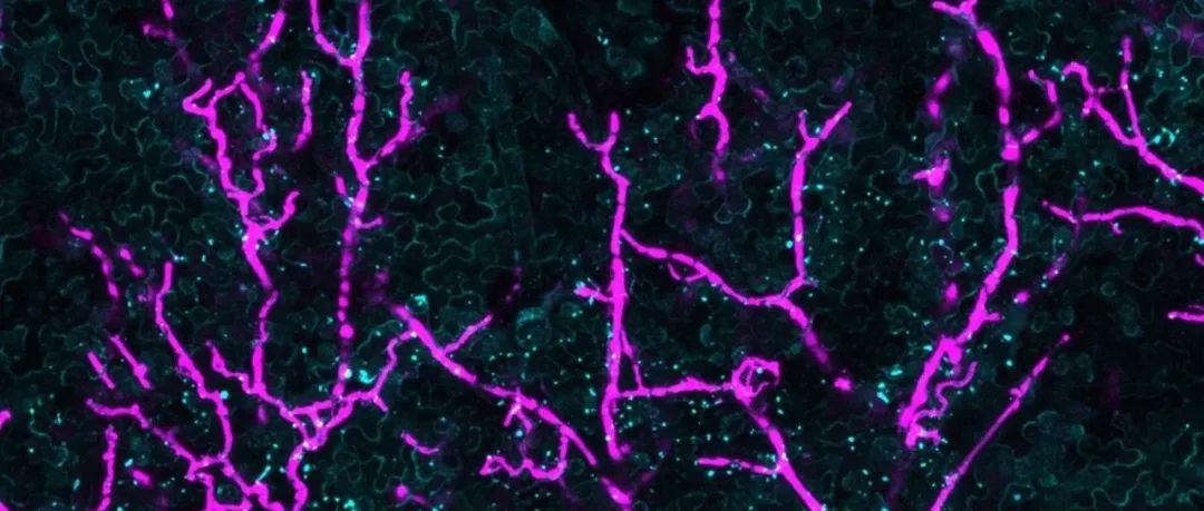 Nature Communications | 南京农业大学王源超团队在植物病原卵菌致病性研究领域取得最新进展！